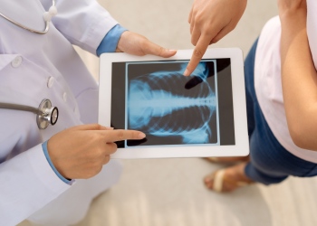 Doctor mostrando radiografía de pulmones y tórax