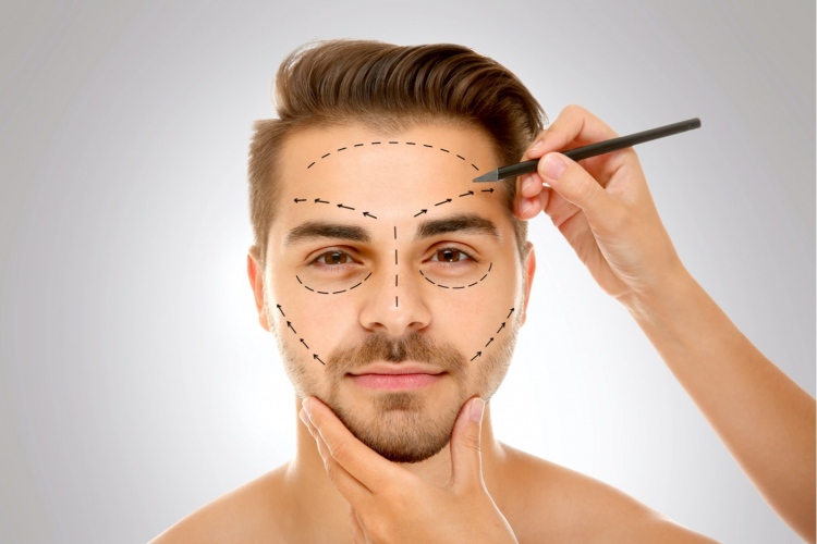 Cirujano dibujando marcas en la cara de un hombre